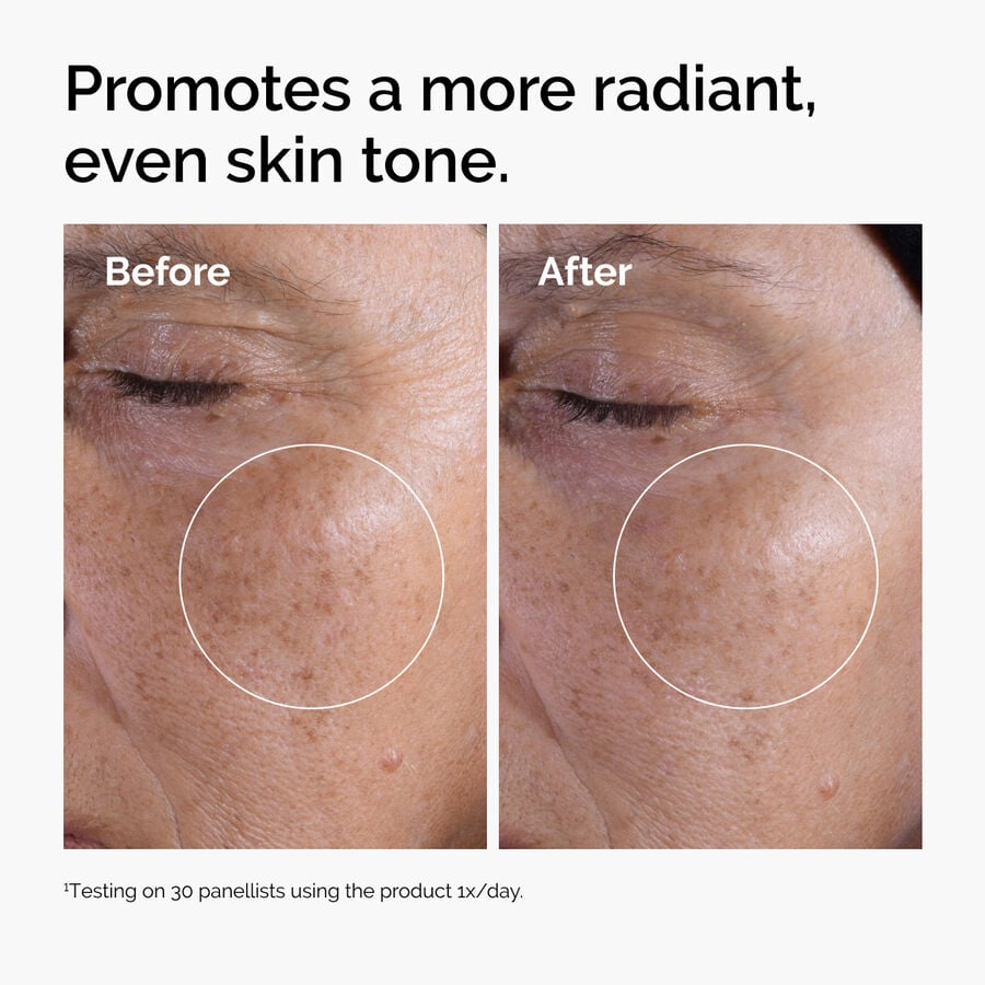 https://theordinary.com/dw/image/v2/BFKJ_PRD/on/demandware.static/-/Sites-deciem-master/default/dw98873246/Images/products/The%20Ordinary/Before-After/ord-glycolic-before-after-radiance.jpg?sw=900&sh=900&sm=fit