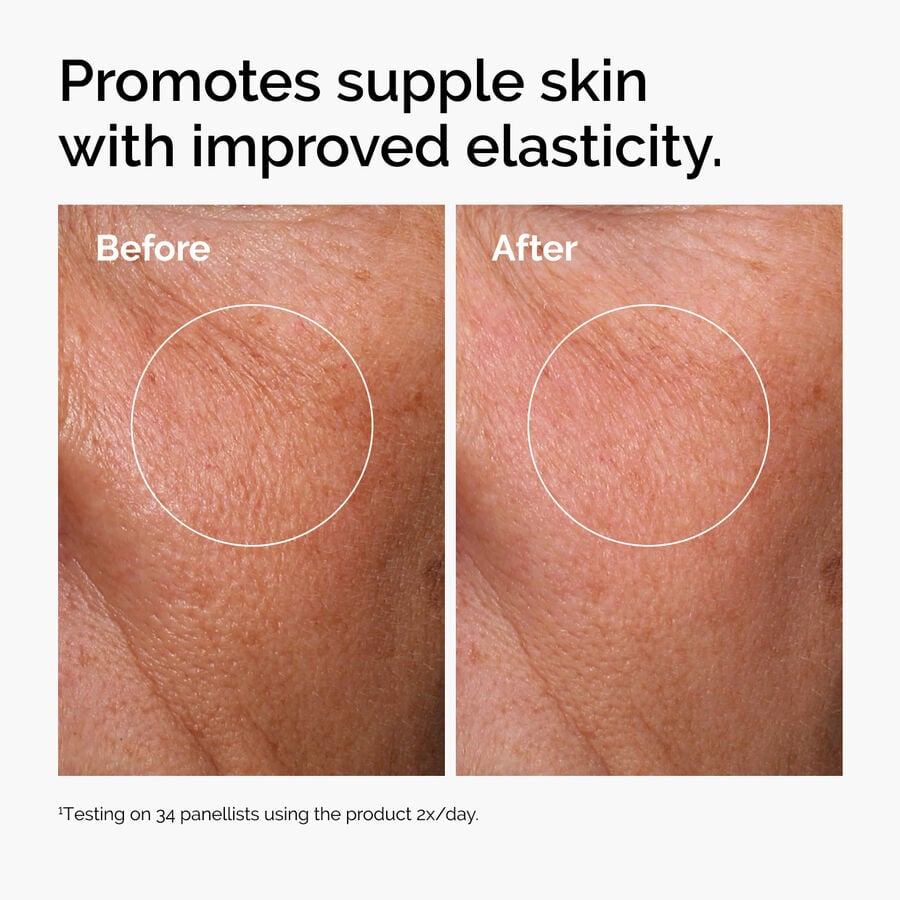 https://theordinary.com/dw/image/v2/BFKJ_PRD/on/demandware.static/-/Sites-deciem-master/default/dw2d521393/Images/products/The%20Ordinary/Before-After/ord-hyaluronic-acid-2pct-b5-hydrating-serum-before-after-elasticity.jpg?sw=900&sh=900&sm=fit